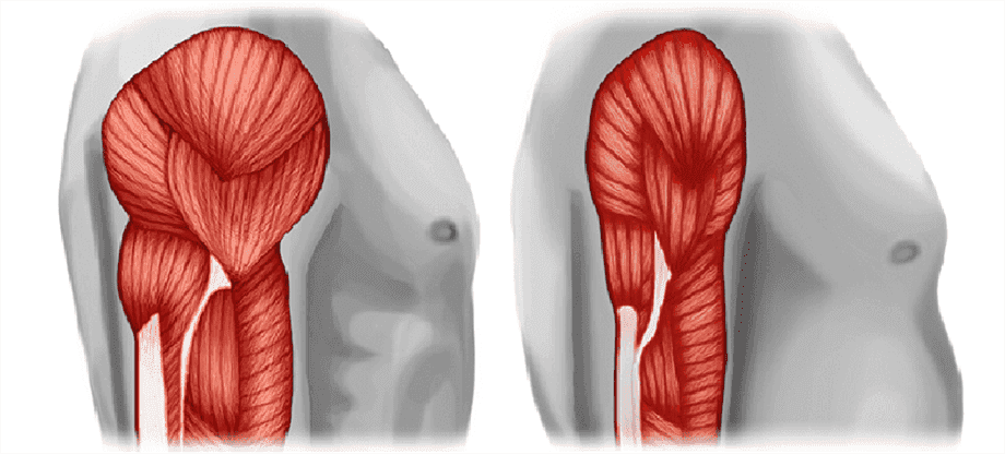 Cos’è la sarcopenia e come si misura