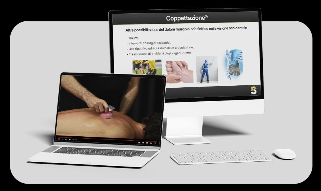 Video-Corso-Coppettazione