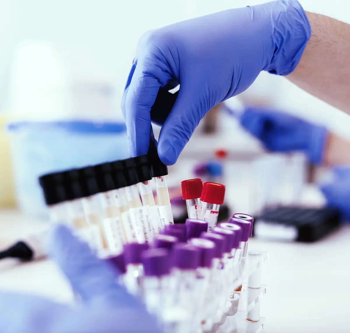 esami di laboratorio