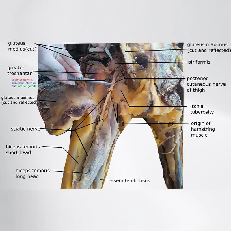 Arto Inferiore-Cadaver-Lab