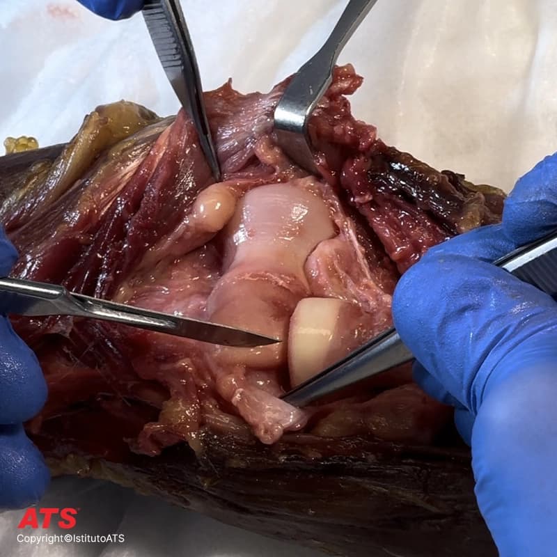 Arto-Superiore-Cadaver-Lab-ATS