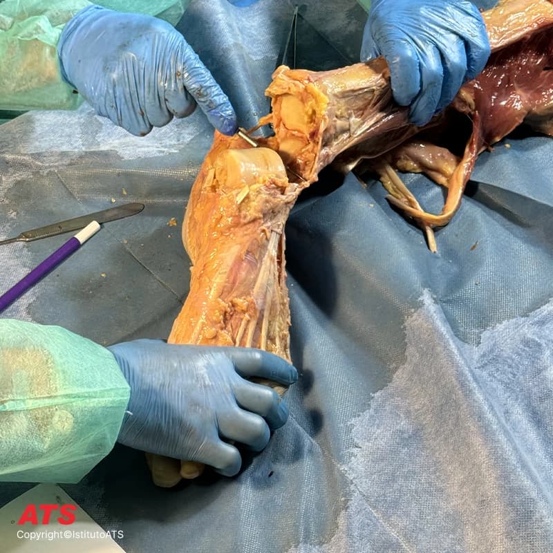 Cadaver-Lab-Arto-Inferiore-ATS
