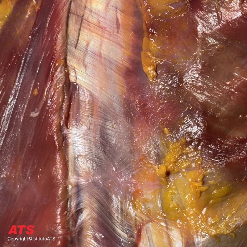 Tronco-Fascia-Cadaver-Lab-ATS