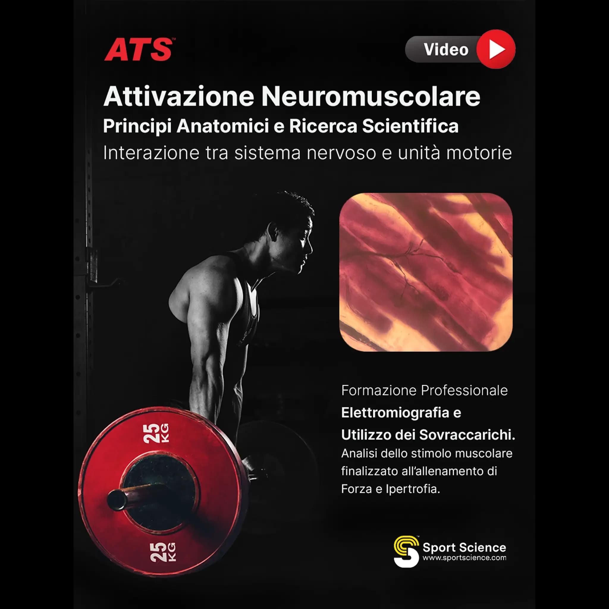 Video Corso EMG sovraccarichi