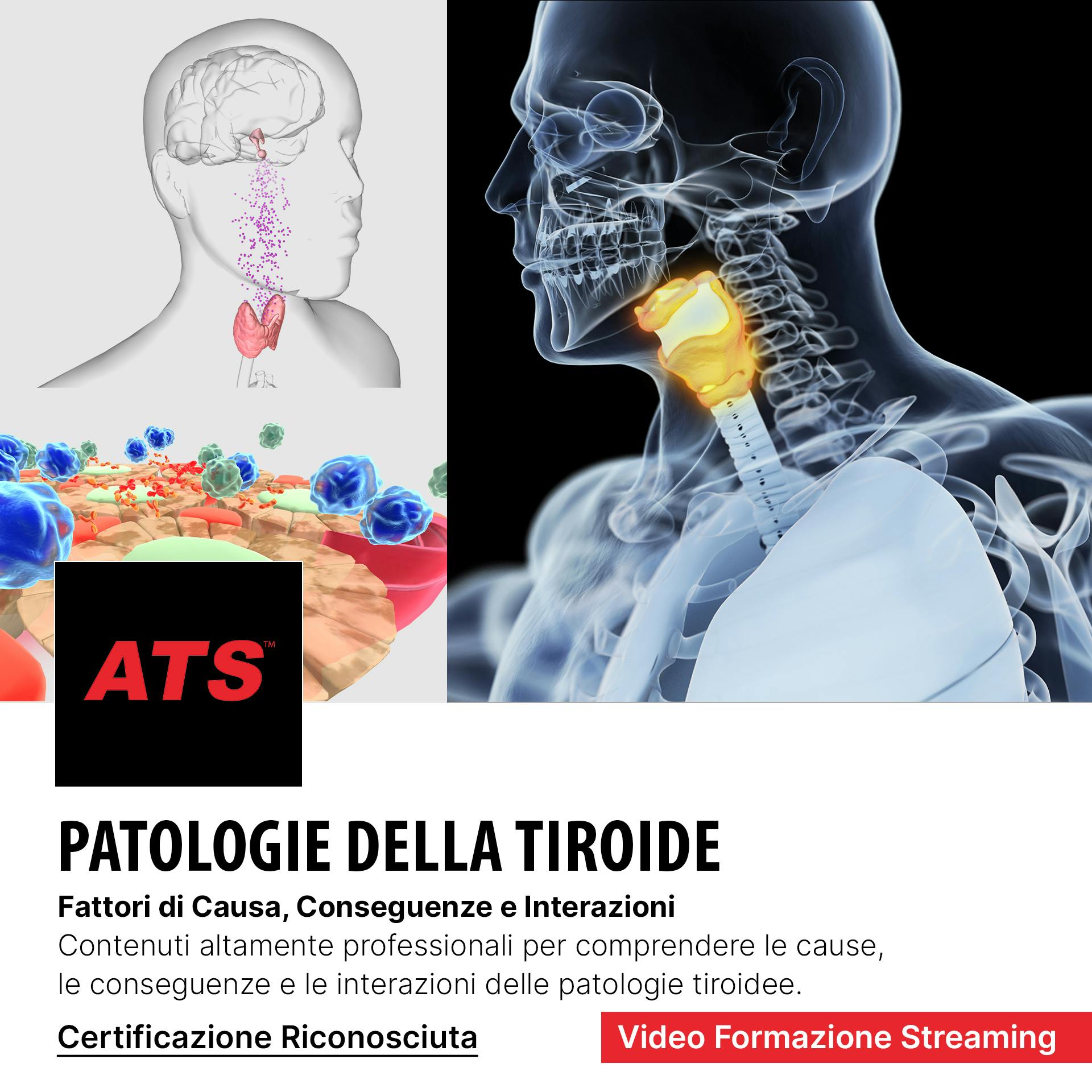 Patologie della tiroide video corso