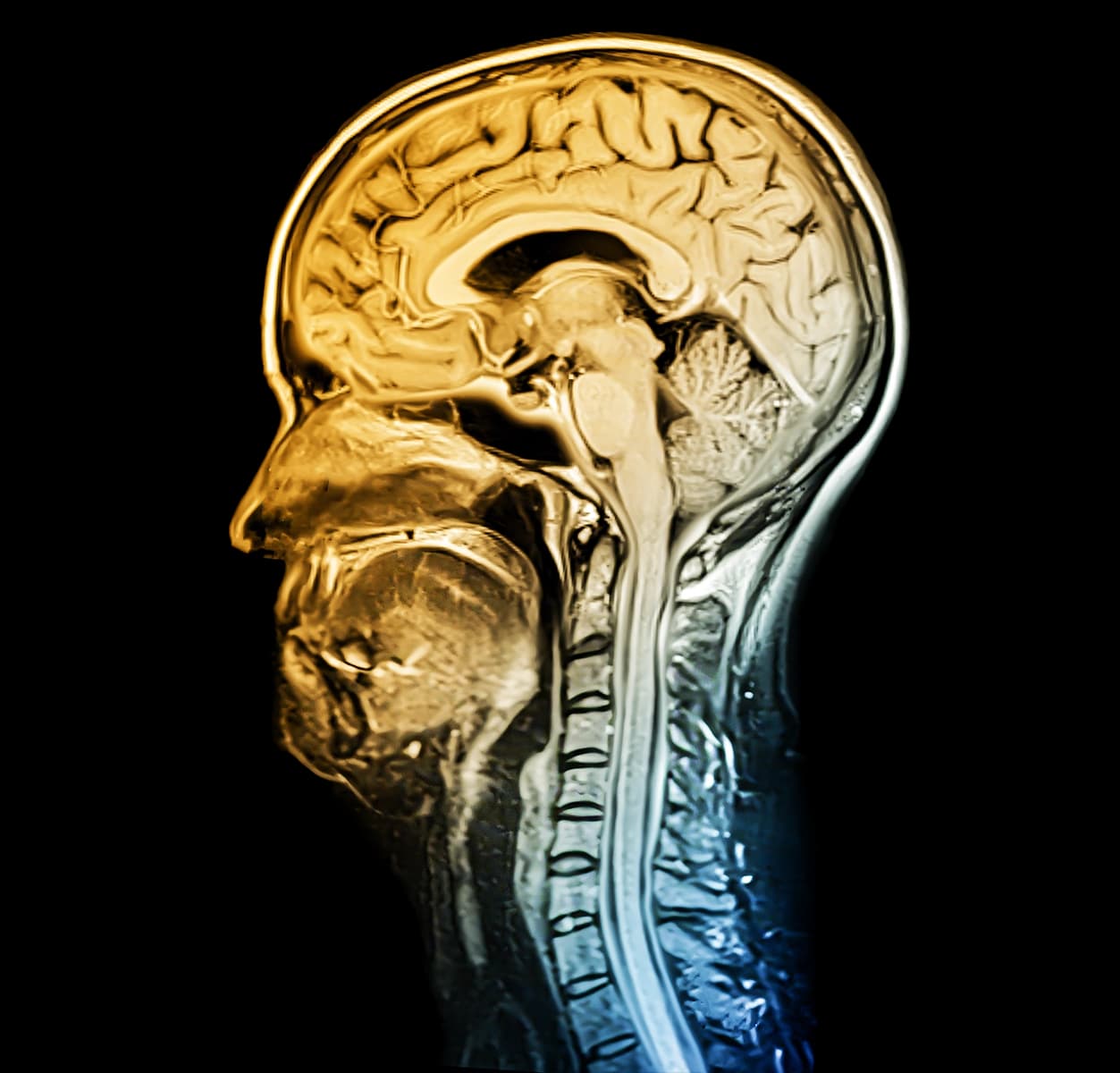 Master-Psicologia-dello-Sport-ATS